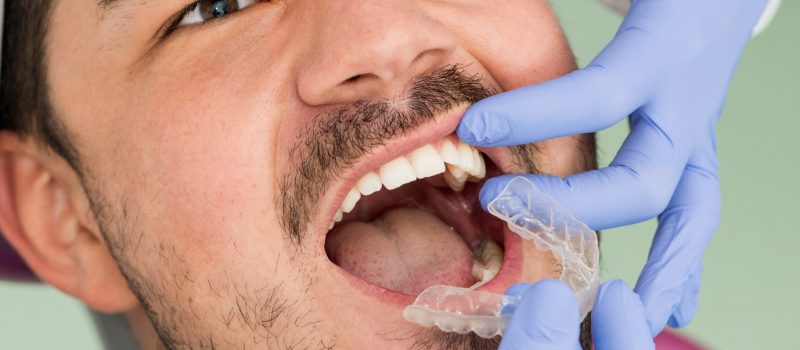 choosing an orthodontist